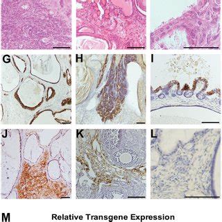 High Smad Dn Transgene Expression On A Fvb Background Results In