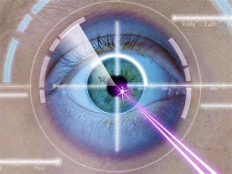 Lasik Eye Surgery What You Need To Know Before Undergoing A Lasik Surgery