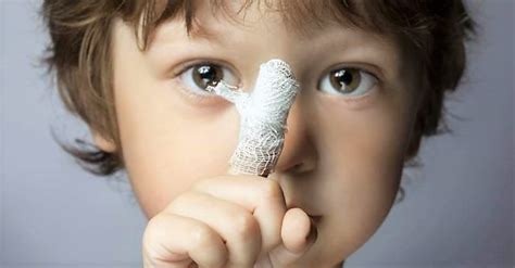 care  minor injuries cuts  scrapes doctor zara