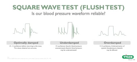 Square wave test (Flush Test) - Campus Vygon