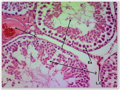 A Transverse Section In Rat Testis From The Two Weeks Alcl 3 Download Scientific Diagram