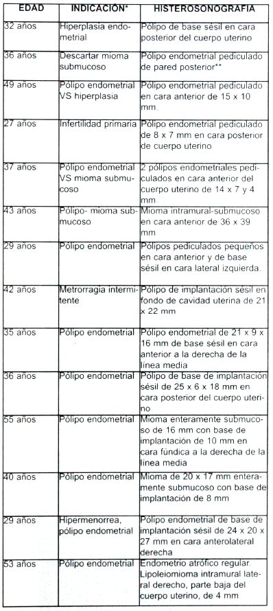 Ultrasonido De Pólipos Cervicales