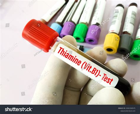 Blood Sample Vitamin B1 Thiamine Test Stock Photo 2265350575 Shutterstock