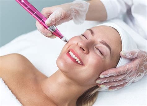 Nano Needling Facial Treatment In Ann Arbor Mi