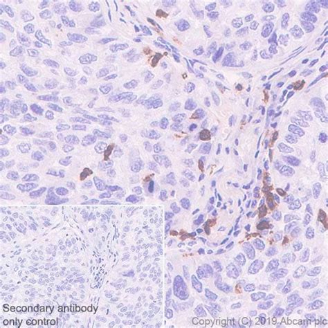 Recombinant Anti-CD103 antibody [EPR22590-27] (ab224202) | Abcam