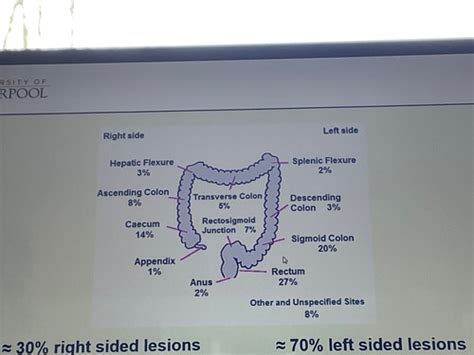 Yr Gi Lecture Development Of Neoplasia In The Upper And Lower