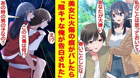 【漫画】6年前に少女を助けて首に火傷の痕が残った俺。クールで有名な学校一の美少女に「この首の火傷って！？」とバレたら、なぜか俺の世話を焼く