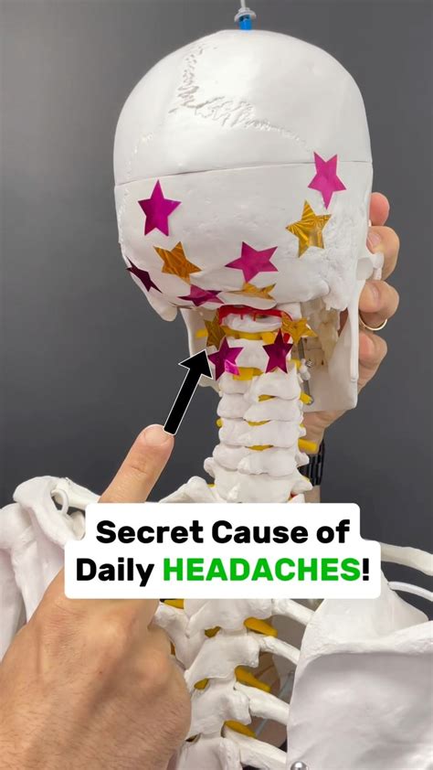 Comment the word “FIX” on this post if you’ve been experiencing ...