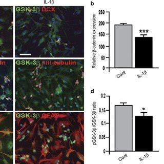 The effect of IL 1β on glycogen synthase kinase 3β GSK 3β activity in