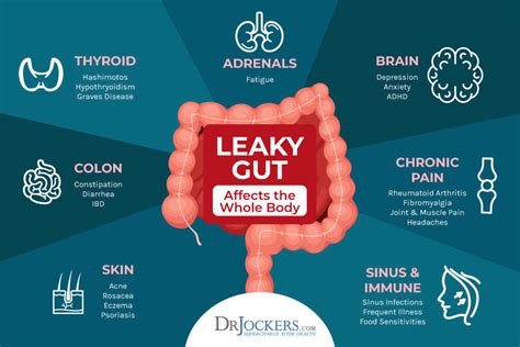 Intestinal Permeability Histamine And Leaky Gut Functional Lab Markers