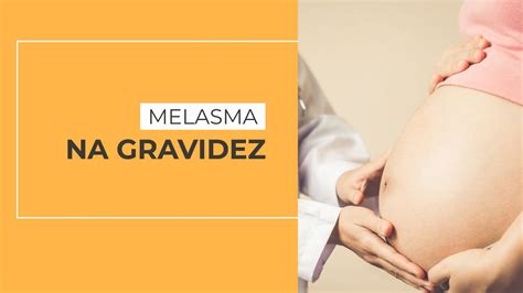 Como Evitar Melasma Na Gravidez - Melasma Na Gravidez: Como Evitar E Tratar – NQETJ