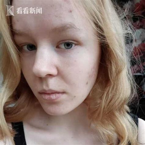 荷兰少女三遭施暴难释怀获准安乐死？ 新闻频道 和讯网