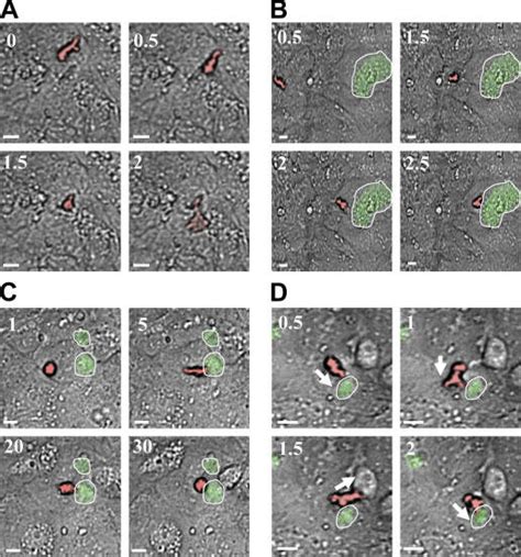 Live Imaging Of Neutrophils Adhering On Human Endothelial Cells