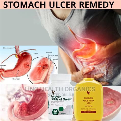 Stomach Ulcer Remedy In Airport Residential Area Vitamins And Supplements Lino Health Organics