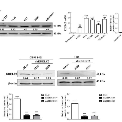 Kdelc2 Expression Correlated With Glioblastoma Development A High