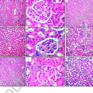 Representative Light Photomicrographs Of Renal Cortical Sections