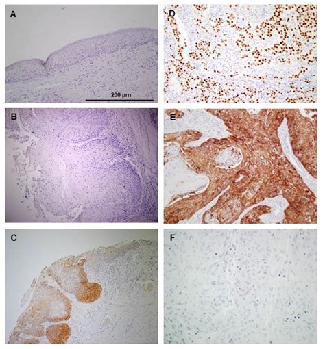 Jcm Free Full Text The Emerging Role Of Nanog As An Early Cancer