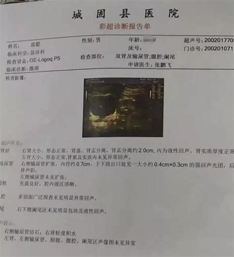 超声检查报告单图解超声心动图单解读产科超声检查大山谷图库