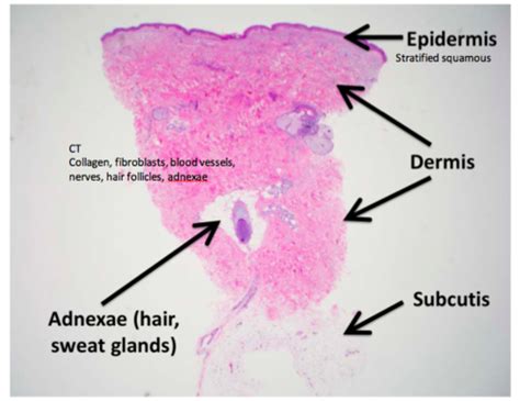 MSK Derm Review Flashcards Quizlet