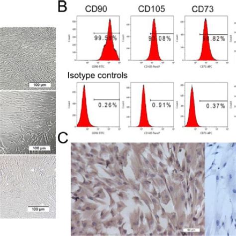 Morphology And Characterization Of Human Amniotic Mesenchymal Stem