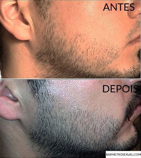 Como Fazer Barba Crescer Mais Rapido Bar Metrosexual