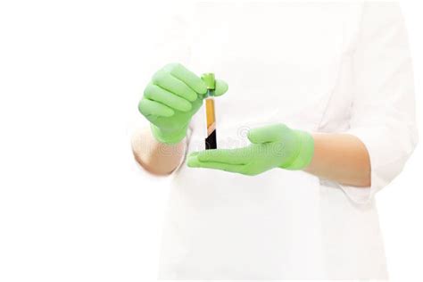 Medical Test Tube With Blood Plasma In Hand For PRP Therapy After