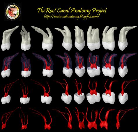 The Root Canal Anatomy Project: Maxillary Second Molar