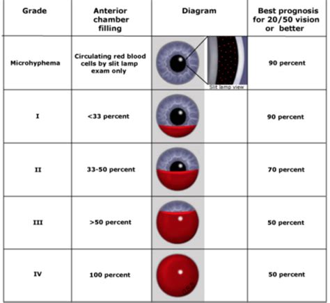 Eye Emergencies Flashcards Quizlet