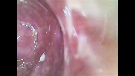 Viral Real Pussy Orgasm Contraction Cam Inside Pussy Sperm Found In Pussy Juice Under