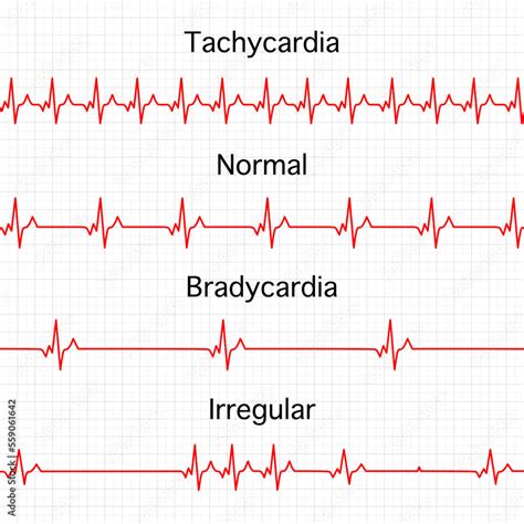 Vettoriale Stock Heart Rate Graphics Vector Illustration