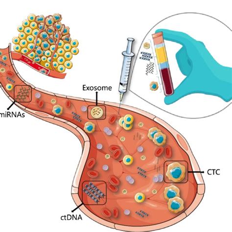 A Schematic View Of Liquid Biopsy Blood Collected From Cancer Patients