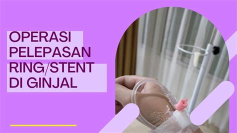 Operasi Pelepasan Ring Stent Di Ginjal Youtube