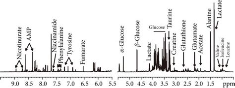 H Nmr Based Metabolic Profiles Patterns In Septic Mouse Treatment With