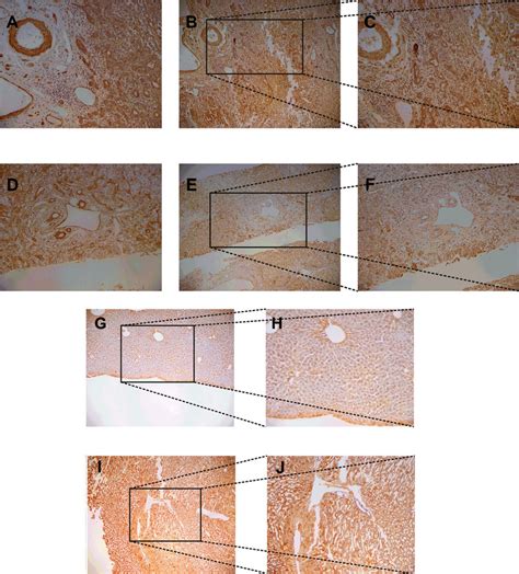 Immunohistochemical Staining Was Conducted In Liver Tissue From Download Scientific Diagram