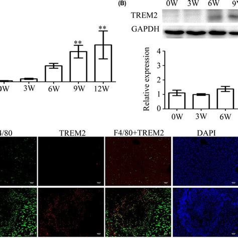 TREM2 Expression Is Upregulated In Livers Of Mice Infected With