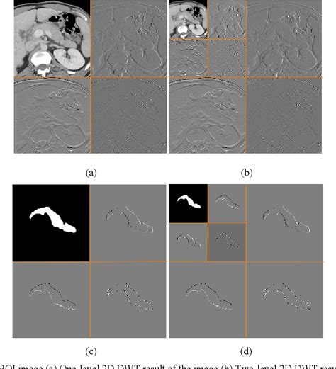 Figure 1 From A Novel Deep Learning Model For Pancreas Segmentation