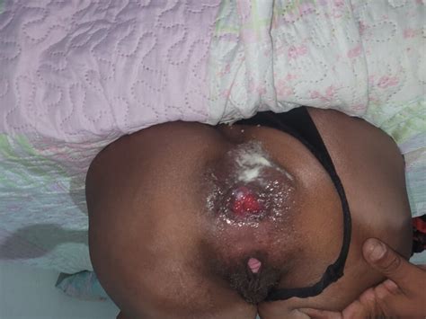 Empregada Domestica Faz Prolapso Anal Muito Aberto Xhamster