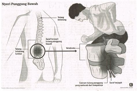 Mengatasi Nyeri Punggung Bawah Kompas 10 November 2021 Hal 8 Library