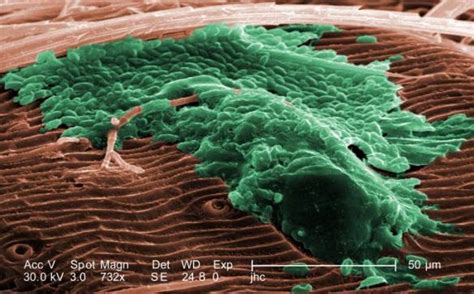 Amyloid Planet Functional Amyloid