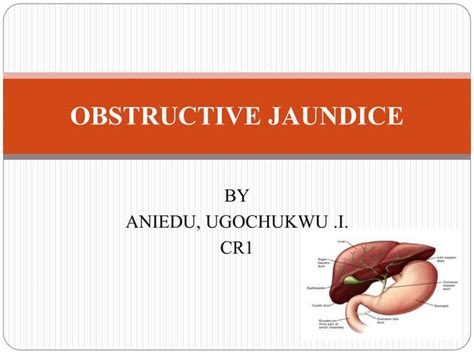 Obstructive Jaundice 1 Ppt