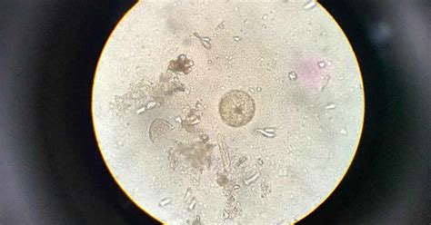 Amoebas And Protozoas Overview Parasiteclinic