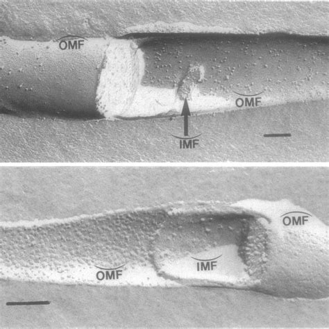 Freeze Fracture Electron Micrographs Of T Phagedenis Reiter A And S