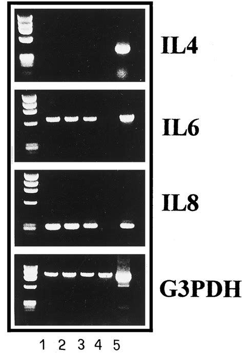PCR amplification of total cellular RNA obtained from FB-1 cells (lane ... 