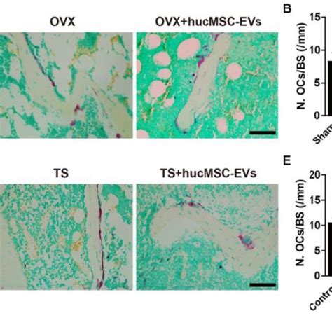 HucMSC EVs Inhibit Osteoclast Formation A Representative Images Of