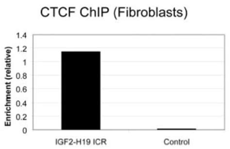 CTCF Antibody Novus Biologicals 0 1mL Unlabeled Fisher Scientific