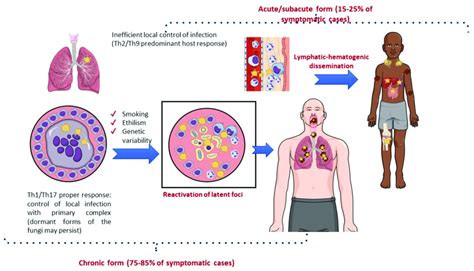 Natural history of paracoccidioidomycosis with a focus on pathogenesis ... 