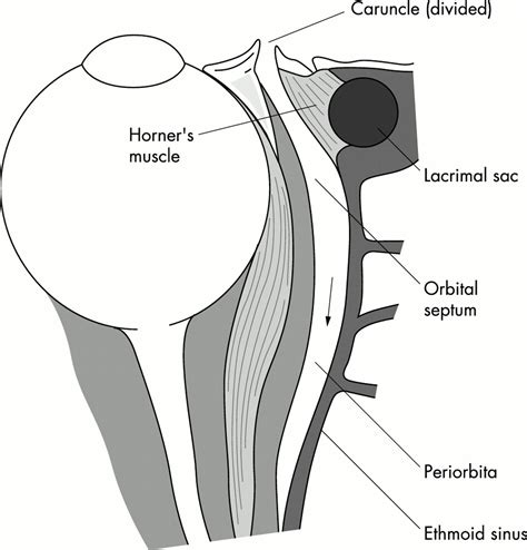 Human Anatomy: Orbit Anatomy