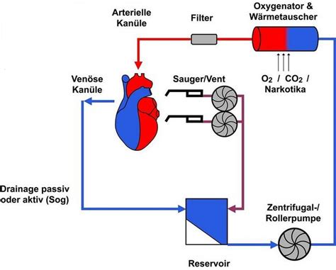 Herz Lungen Maschine UKM Klinik für Herz und Thoraxchirurgie
