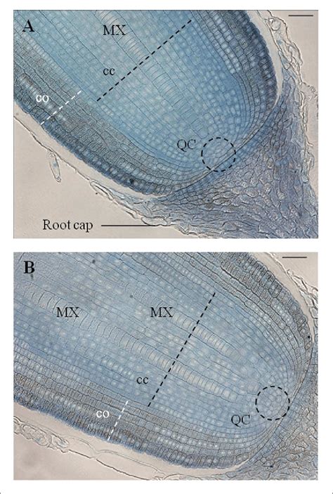 Anatomical Organization Of Primary Root And Crown Apices Observed On