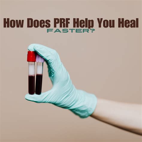 What Is Prf How Does It Help With Oral Surgery Mid State Oral